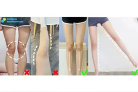 腿型大蜕变 | 膝盖内侧鼓包，弯腿变直腿图片