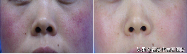 #健康中国行动2030# 约惠“女神节” 这些美容项目全部6·8折