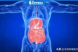 结直肠癌患者福音！新疗法让晚期肠癌肝转移患者重获新生图片