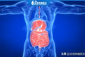 结直肠癌患者福音！新疗法让晚期肠癌肝转移患者重获新生图片