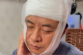 网红大肠哥被打现场曝光：躺在医院动弹不得，刀伤划过半张脸图片