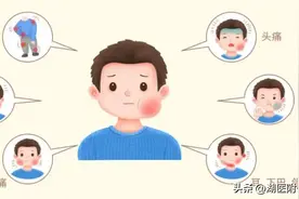 「中医科普」流行性腮腺炎的贴敷疗法图片