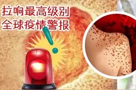 新毒株“更致命”！世卫组织拉响最高级别全球疫情警报！病毒传播方式有变…图片