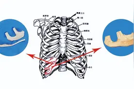 作为耳再造医生，为什么我建议小耳畸形患者选择全包法这种方式？图片
