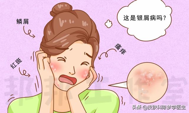 脸皮质角化