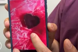 7岁女童误食“巧克力”1天后，莫名四肢抽搐，原因让人捏了一把汗图片