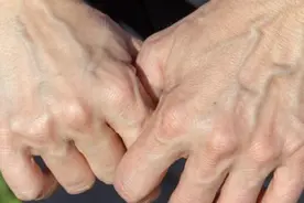 人的血液是红色的，为什么静脉看上去是蓝色的呢？图片