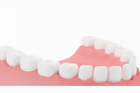 一万块买来的经验和教训（根管治疗➕牙冠➕嵌体）图片