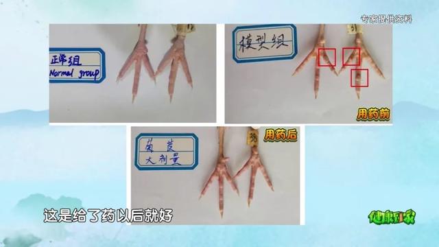 菊苣全身都是“宝”，做菜吃、泡茶喝，清热利湿，降尿酸