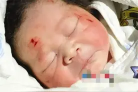 2014年孕妇产检路上车祸身亡，腹中孩子奇迹降生，如今怎样了？图片