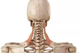 落枕、头痛、眼部不适？可能和这个肌肉有关系-肩胛提肌图片