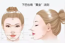 下巴后缩，如何拥有美丽的侧颜？图片