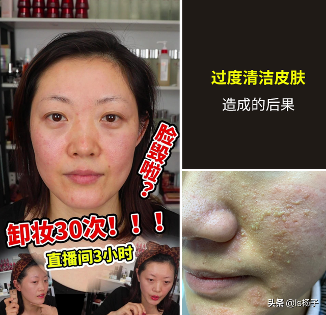 有没有什么一瓶就可以代替多瓶的只擦一种就可以的护肤品？（精）