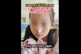 6岁女童吃瑞士卷头孢过敏全身红肿图片