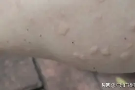 高发季！被这种小虫咬后奇痒无比，街坊：最讨厌它了！图片