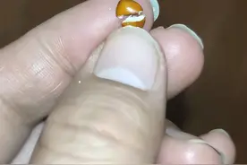 失眠的人看过来！失眠已经够闹心了，咱别再买到假酸枣仁图片