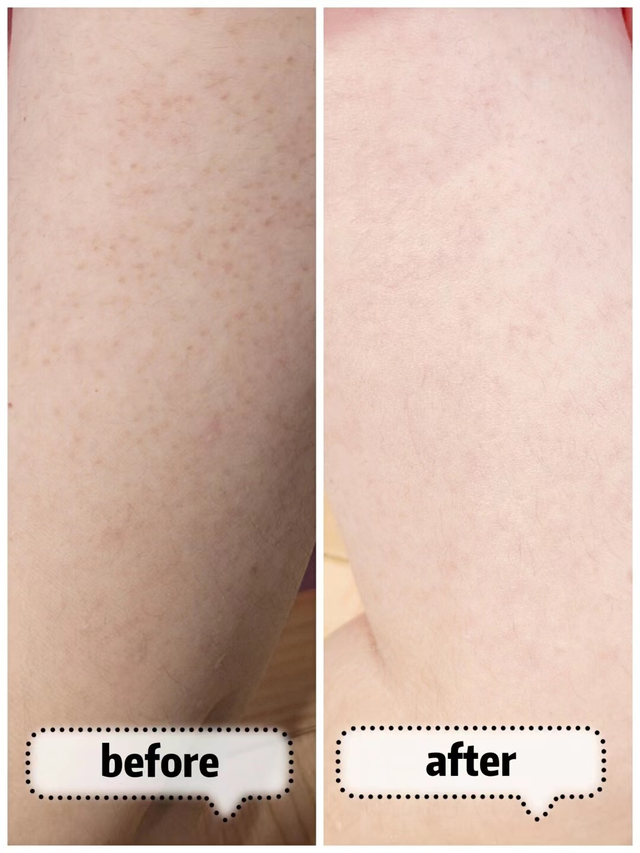 天天都涂身体乳