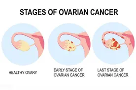 女性半边天：探索卵巢的神奇功能，保护卵巢的健康秘诀！图片