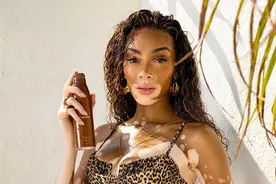 白癜风超模穿豹纹比基尼亮相太火辣！身材确实棒，有NBA男友宠她图片