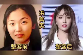 韩国女星整容前后对比，李珍娜判若两人，金泫雅堪称整容模板图片