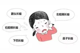 长痘痘的位置不同，原因也不一样哦图片