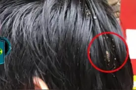 被鸟屎砸头预感好兆头！乐山男子随机10注分享给好友各中1注500万图片