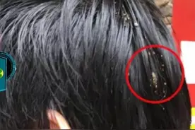 被鸟屎砸头预感好兆头！乐山男子随机10注分享给好友各中1注500万图片