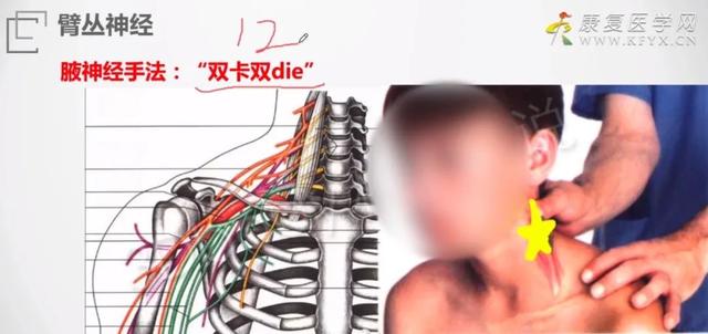 治疗师必备技术——神经损伤手法治疗动作分解