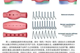 有创动脉压监测：远不止平均动脉压图片