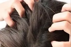 头皮出现问题会带来哪些危害？图片