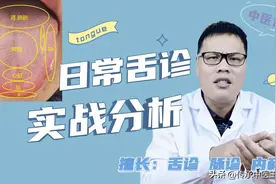 今日舌诊—实战分析—55岁大姐怕冷，早晨起来舌头渗血，怎么办？图片