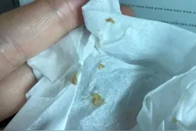 吐出臭臭的黄色颗粒，这是我吃进去的玉米和椰子吗？图片