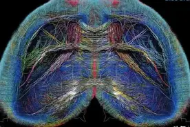 科学家在人脑中发现了多维“宇宙”:一个高达11维的神秘结构图片