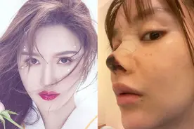 孙菲菲李心艾等的“消失”，证明整容上瘾，不只“毁容”那么简单图片