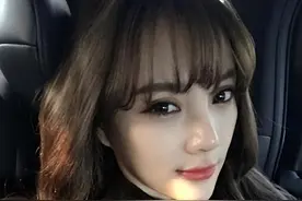 “整容上瘾”女生自述：从16岁开始整容，手术上百次，花了300万图片