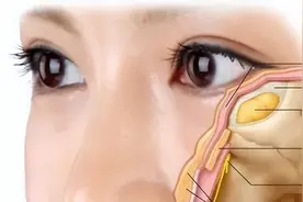 你是什么眼袋类型？怎么治疗最有效？一篇全知图片