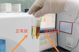 小便发黄，真的是上火吗？图片