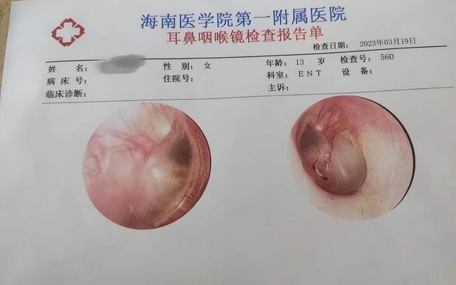海南13岁女孩遭霸凌鼓膜穿孔，校园霸凌何时休？