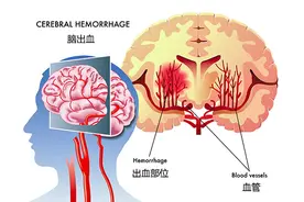 撞到头部多久是危险期图片