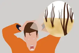 后脑勺总容易长疙瘩，到底是啥东西？严不严重？该怎么办？图片