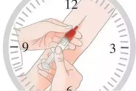 癌症患者抽血复查需要空腹吗？图片