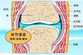 关节积液反复折磨？9个方法帮您缓解图片