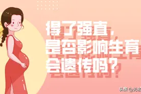 强直会遗传吗？基因可筛吗？图片