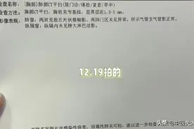 34岁的她阳后发现1厘米肺结节，做了手术后，病理已经是微浸润了图片