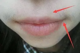 女性长胡须？多与卵巢疾病有关，一个古方，轻松去掉小胡子图片