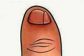 若你的小脚趾有2瓣趾甲，或许不是纯正汉人，而是鲜卑族的后代图片