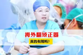 拇外翻矫正器真的有用吗？说了一万次了图片