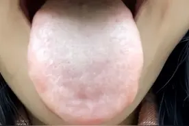 夜尿多、怕冷、腰酸痛，你需要补肾了图片