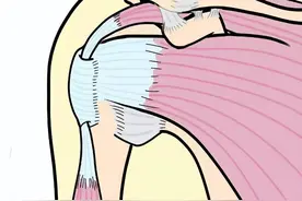 手臂抬举困难、肩膀酸痛？近35%的肩痛都与它有关图片