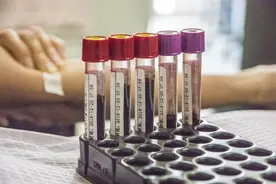 医生动不动就抽血，抽血到底能干啥？抽出来的血去哪了？图片